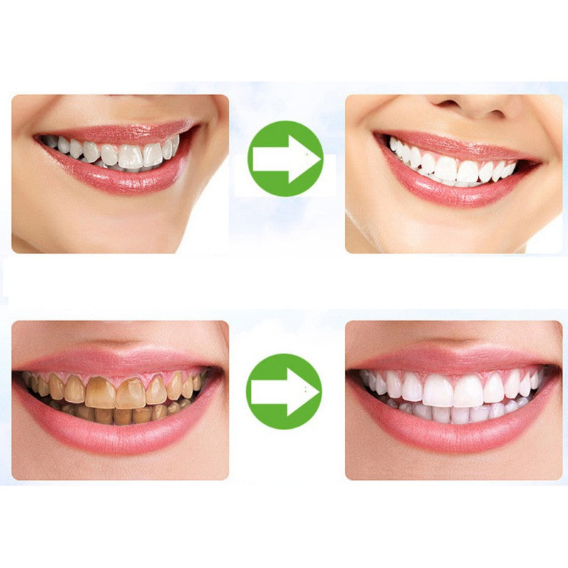 Organic Coconut Activated Charcoal Teeth Whitening Powder 30g