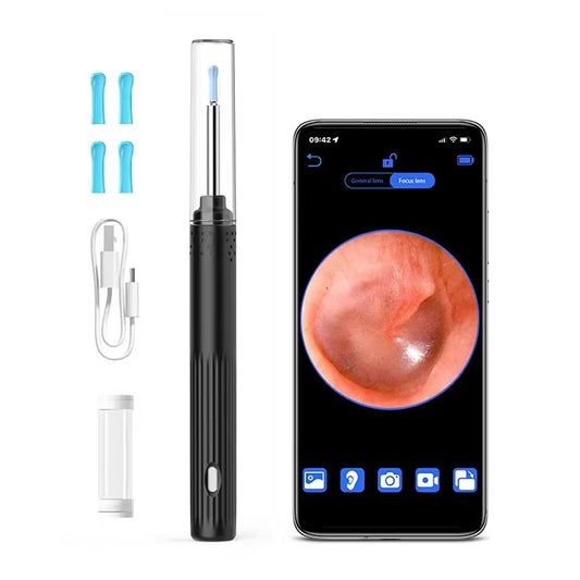 Intelligent Visual Ear Endoscope