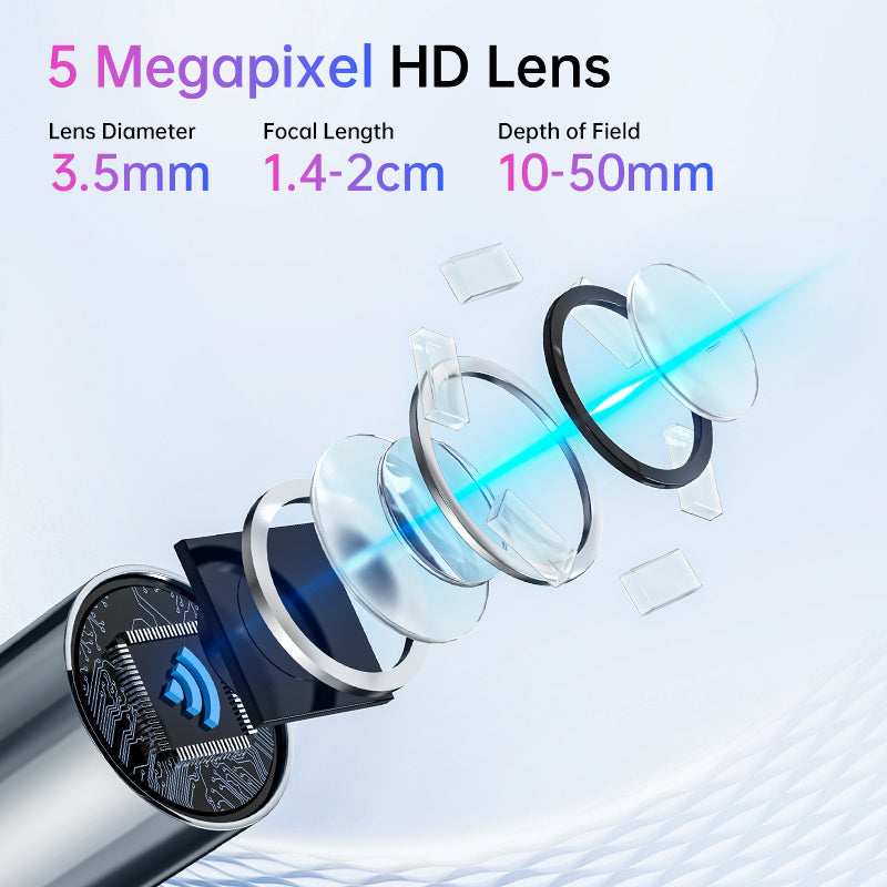 Intelligent Visual Ear Endoscope