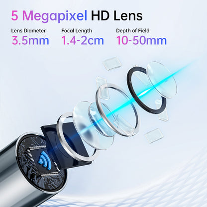 Intelligent Visual Ear Endoscope