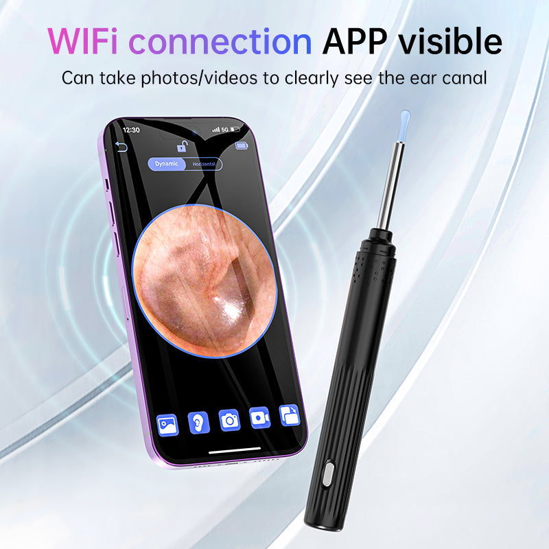 Intelligent Visual Ear Endoscope